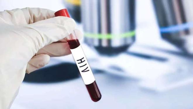 “静”享健康丨世界艾滋病日：关于艾滋病这些知识要了解(图2)