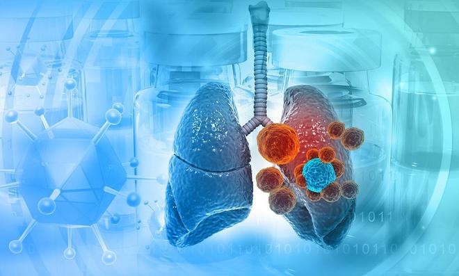 研究发现：氡气被确定为肺癌的主要致病因素氡气又在哪些地方呢(图4)